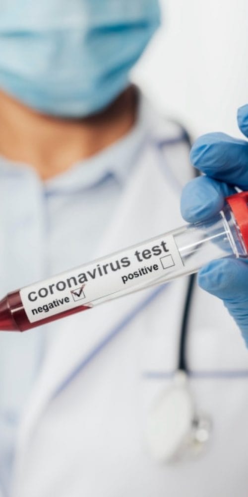 close-up-doctor-holding-coronavirus-test